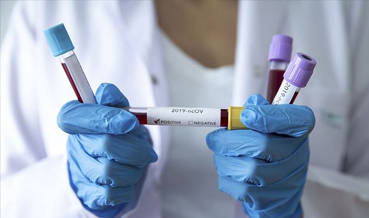 Almanya koronavirüs salgınını 8 yıl önce öngörmüş
