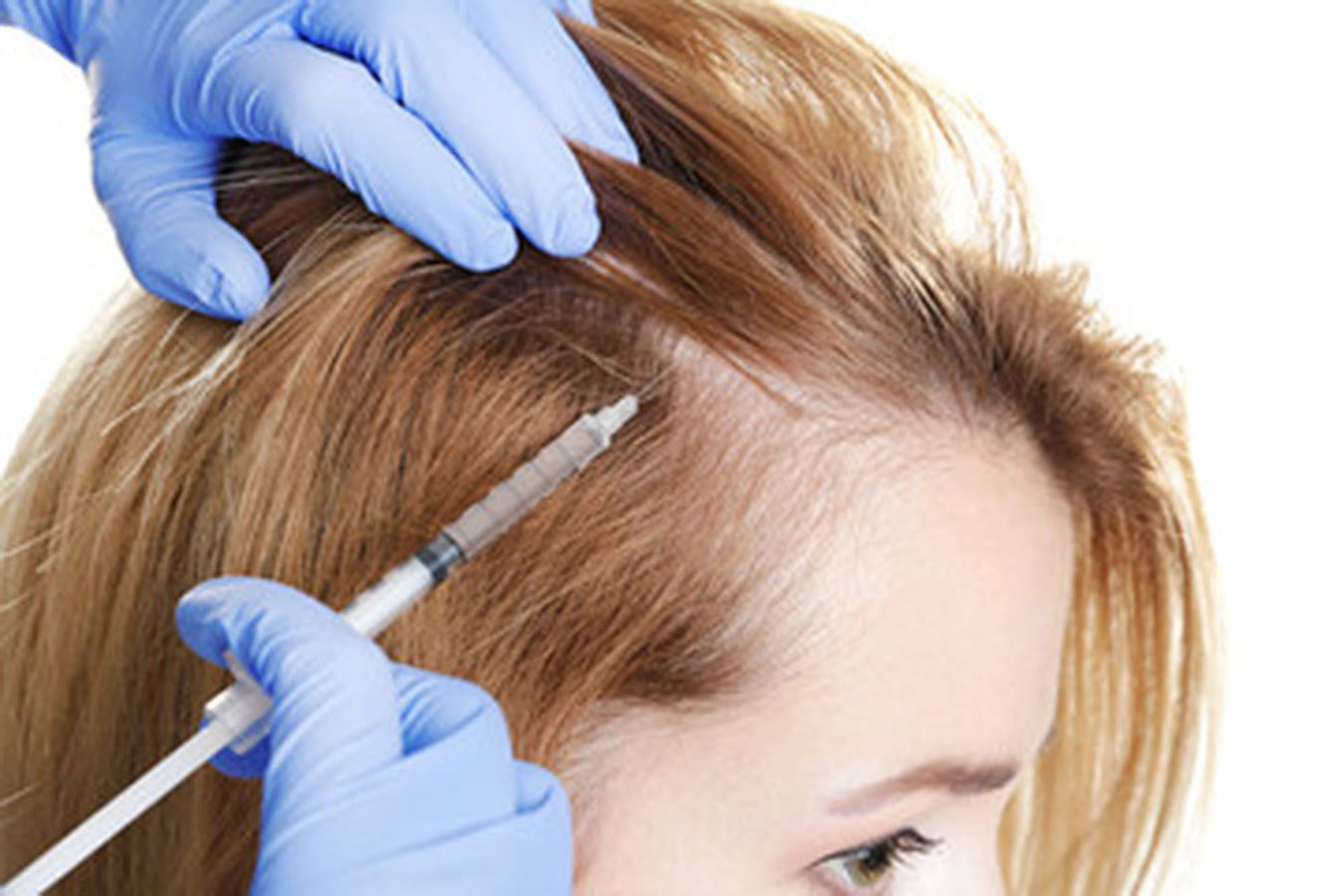 Koronavirüsten dökülen saçlar nasıl çıkar? Gür saçlara sahip olmak hayal değil
