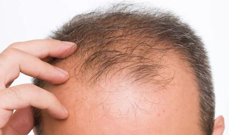 Araştırma: Enerji içeceği erkeklerde saç dökülmesine neden oluyor