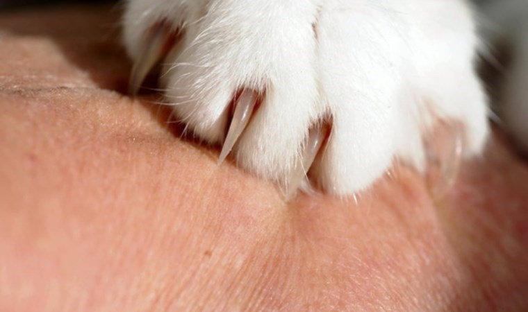 Uzmanı uyardı: 'Kedi tırmığı' hastalığı her yıl giderek artıyor