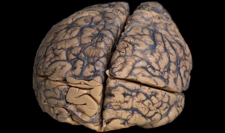 Akıl hastalıklarına ışık tutacak! 8 bin yıllık antik beyin....