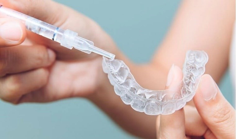 Diş beyazlatma ve protez jel tırnak kitlerinde tehlike: 'Zararlı kimyasallar tespit edildi...'