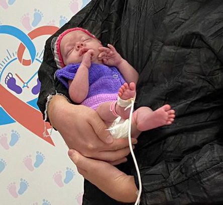 <p>Mihra bebek, akciğer gelişimini tamamlaması için 10 gün daha anne karnında yaşatıldı ve Türk doktorlar bir mucizeyi başararak, Türkiye'de ilk kez bir Covid hastasına ECMO cihazı altında başarılı bir sezaryen operasyonu gerçekleştirdi.</p><p>Mucize bebek Mihra, prematüre doğduğu için birkaç gün yeni doğan yoğun bakım servisinde izlendikten sonra normal servise alındı. Dünya prematüre gününü de gözlem altında tutulduğu hastanede, babasının kucağında geçirdi. Genç anne ise toplamda 40 gün süren ECMO tedavisinden zaferle çıktı ve geçtiğimiz hafta cihazdan ayrılarak normal servise alındı. Kavuşacakları günü bekleyen anne ve bebek, Türkiye'de ilk, dünyada da birkaç vakadan biri olarak tıp camiasının da ilgi odağı oldu.<br></p>