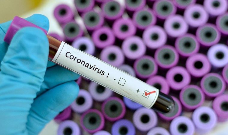 Bilim insanları açıkladı: Koronavirüsü öldürdüğü ortaya çıktı