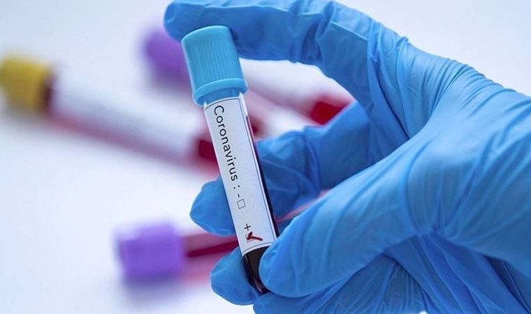 İBB'de koronavirüs nedeniyle bir ölüm daha!