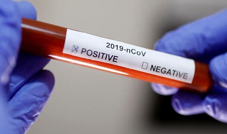 Koronavirüsün kırıp geçtiği İtalyanlar araştırdı: Virüsü yenmek tek başına yeterli değil
