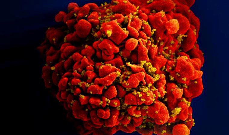 Bilim insanlarından HIV virüsünün bulaştığı ilk insanla ilgili beklenmedik tahmin