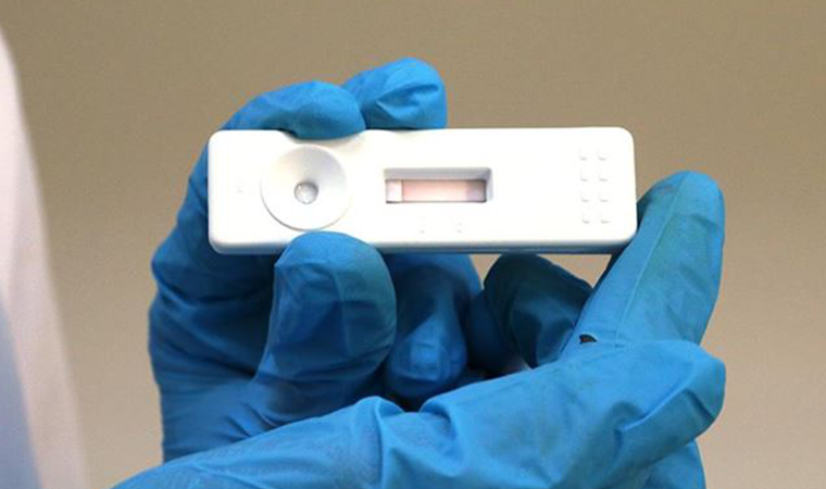 Hızlı koronavirüs test kitleriyle ilgili önemli uyarı