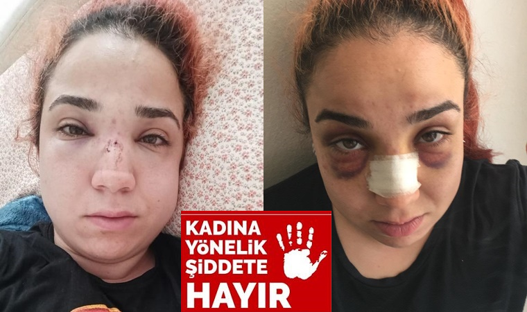 İzmir'de kadın çalışana süpürgeli dehşet!