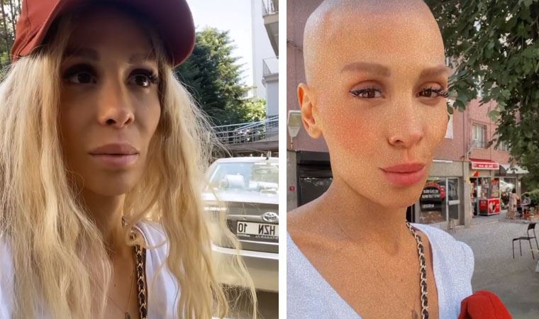 Şarkıcı Şimal, kanseri yendiğini peruğunu çıkararak duyurdu