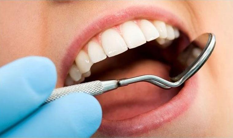 Diş iltihabına ne iyi gelir? Diş iltihabı nasıl geçer? Www.cafemedyam.com 