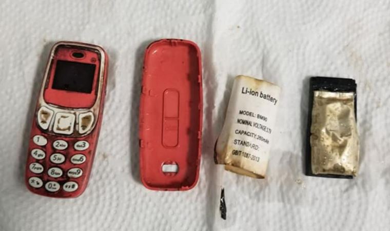Kosova'da hastanın midesinden ameliyatla Nokia 3310 çıkarıldı