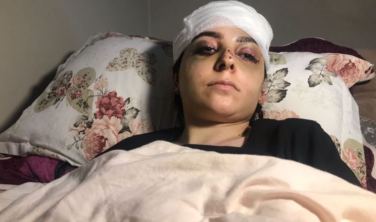 İstanbul’da ‘tayt’ şiddeti: Öldüresiye dövdü, serbest kaldı