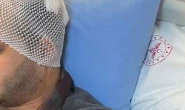 Gaziantep'te doktoru mermerle yaralayan saldırgan tutuklandı