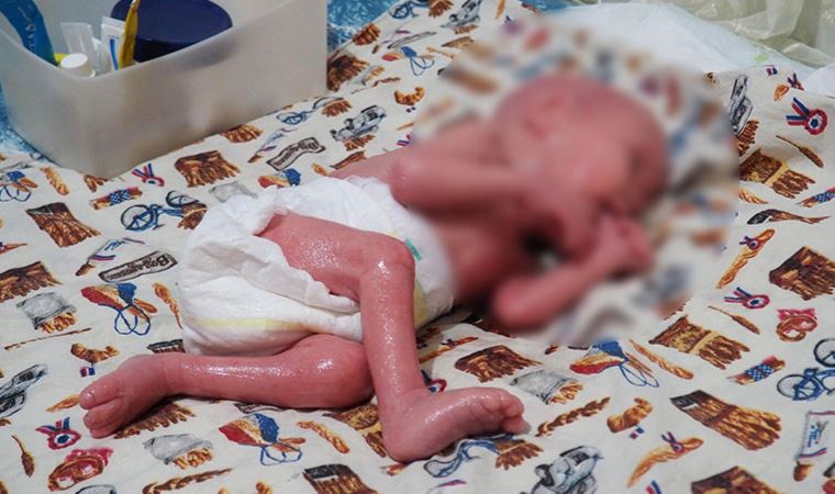 300 milyonda bir görülen hastalığa yakalanan bebek 1 yaşında: 'Oğlumu öpmemiz yasak'