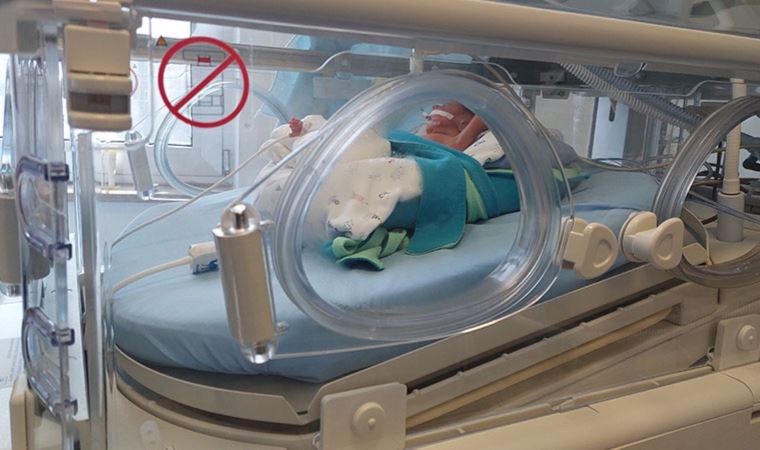 495 gramlık prematüre bebeğe kök hücre nakli yapıldı