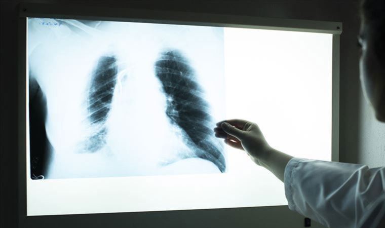Göğüs Hastalıkları Uzmanı Doç. Dr. Gülistan Karadeniz: 'KOAH'ta ölüm oranı artıyor'