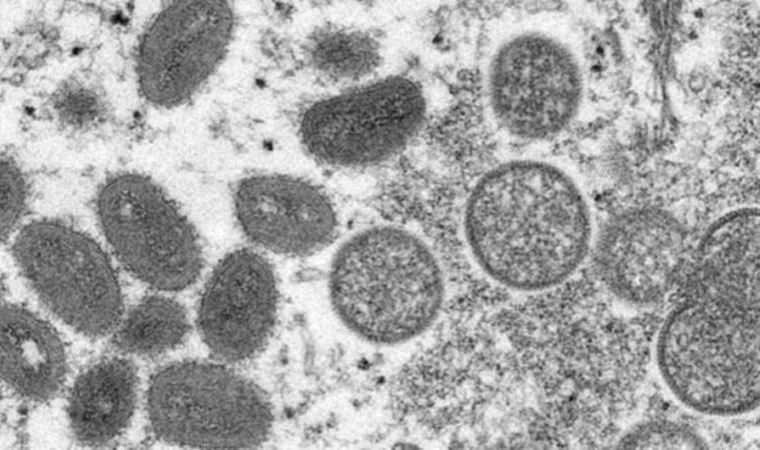 Allarme virus Monkeypox in Europa: si è diffuso in un altro Paese