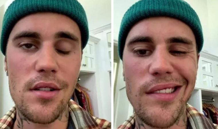 Şarkıcı Justin Bieber kısmi yüz felci geçirdi