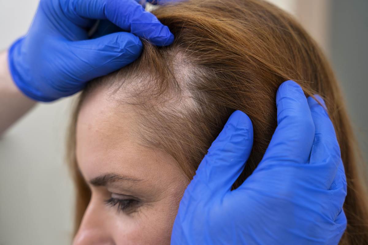 150559935 woman getting hair loss treatment clinic 1