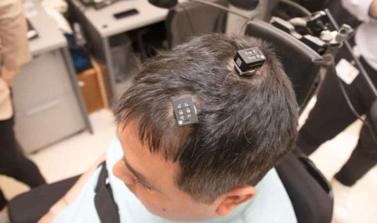 Yapay zeka destekli beyin implantı devrim yaratabilir