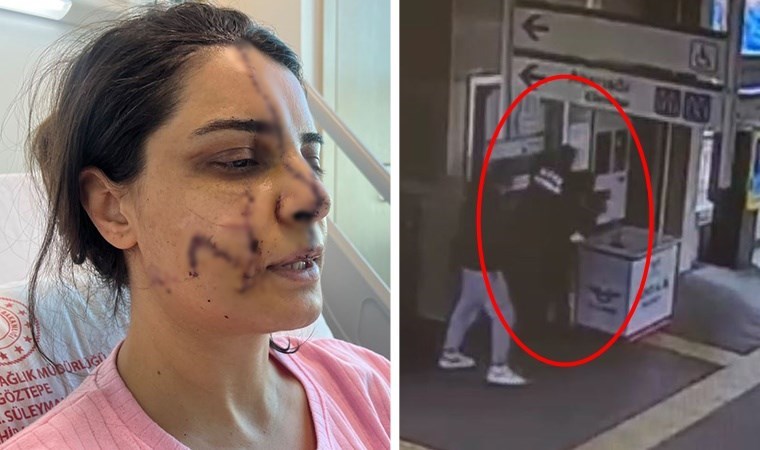 Marmaray İstasyonu'nda saldırıya uğrayan kadın, yüzündeki 40 dikişle dehşet dolu anları anlattı: Telefonla arayıp haber vermiş!