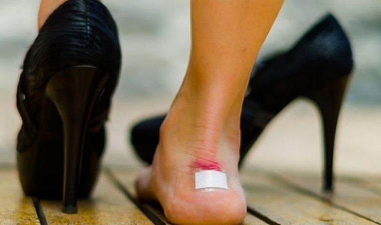 Ayakkabı vurduğunda oluşan yaralara 5 etkili çözüm Birkaç kullanımda yaralarını